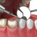 From Flossing to Fillings: Navigating Dental Care Solutions